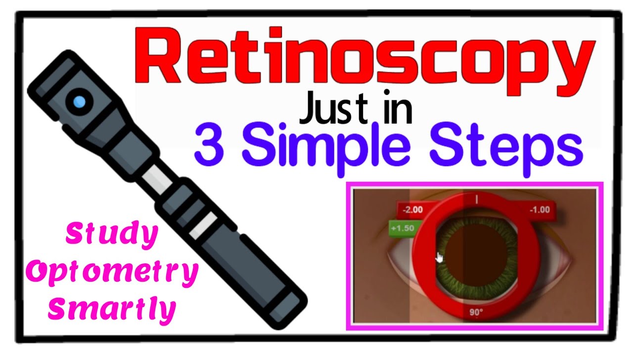 Retinoscopy in 3 Simple Steps YouTube