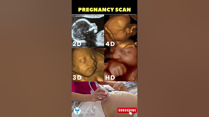 See your Baby face 😍 in pregnancy | 2D/ 3D/ 4D & HD baby Scan ✅ Pregnancy scan reports #shortsvideo