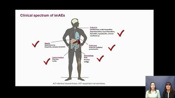 Checkpoint inhibitors: monitoring and management of imAEs - video abstract ID 141577