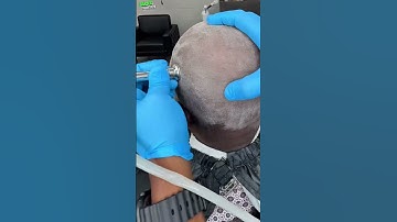 Mega ASMR Bald Head Massage✂️