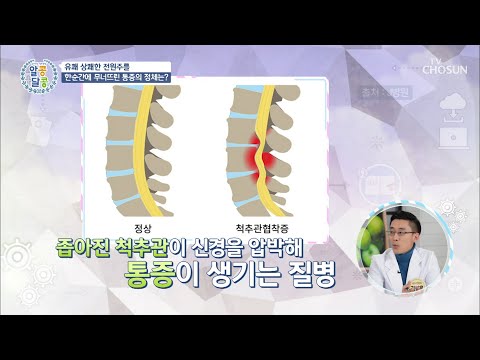 ※50대 이상 94%가 걸리는 질병※ 원인은 하이힐?!  [알콩달콩] 16회 20200130
