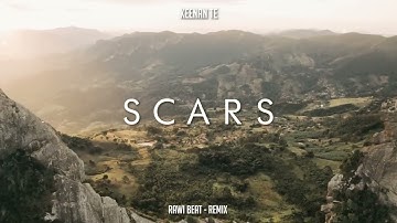 Dj Slow Remix !!! Rawi Beat - Scars - Keenan te ( Slow Remix ) Lagu enak didengar saat santai