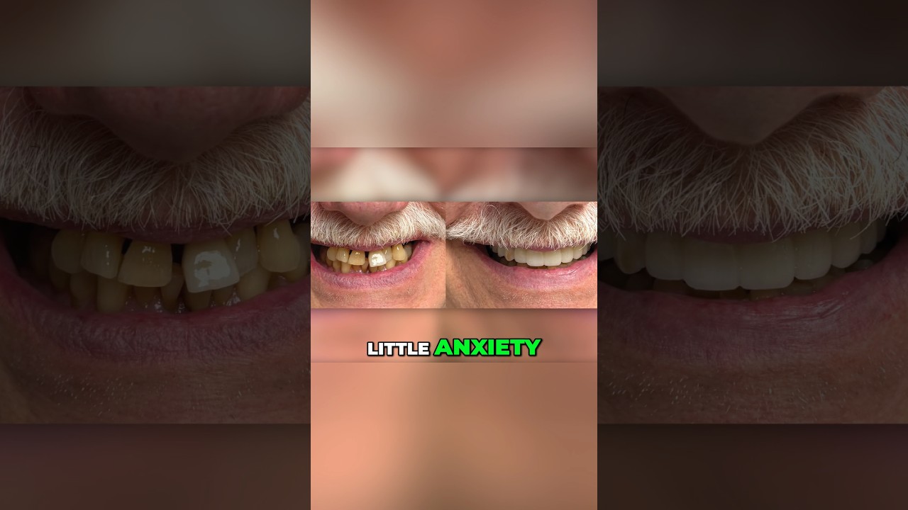 "Game Changer" for Dental Implant Surgeries - As Little As 2-3 Hours ⏰