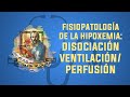 Hipoxemia: Disociación ventilación/perfusión