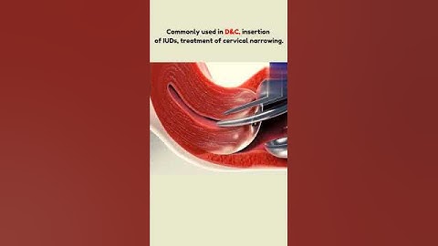 Cervical Dilatation 🥺 #shortsvideo #share #foryou