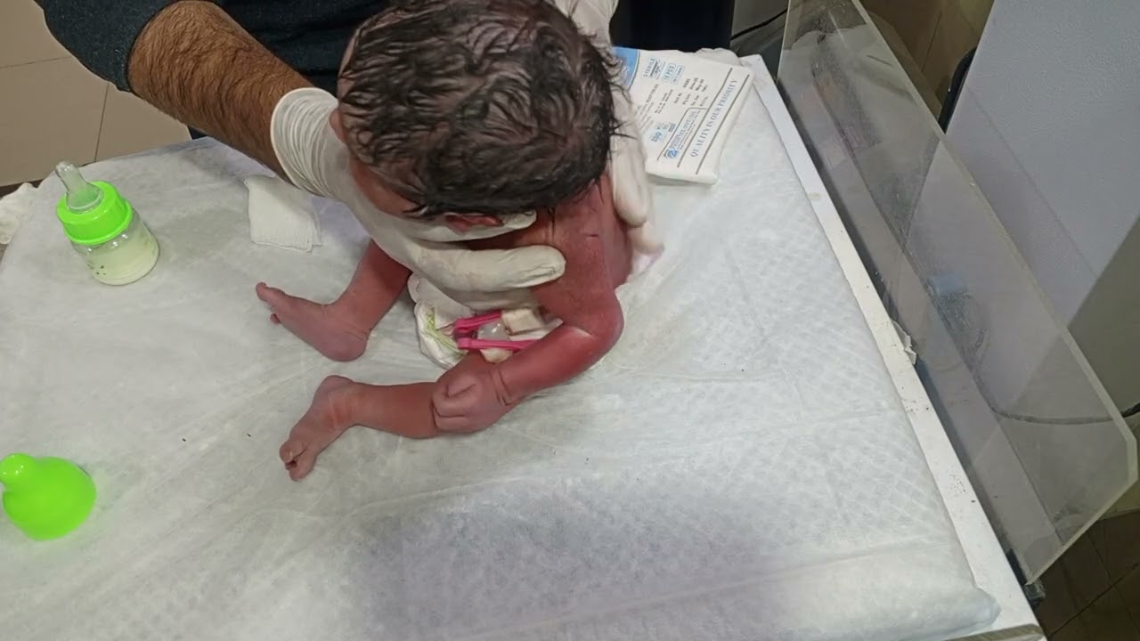 Newborn Baby’s First Bottle Feeding 🍼 | NICU Care & Initial Assessment | NICE Guidelines