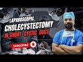 Laparoscopic cholecystectomy in short cystic duct✅ l #doctor #surgeon #gallbladderstones #yt