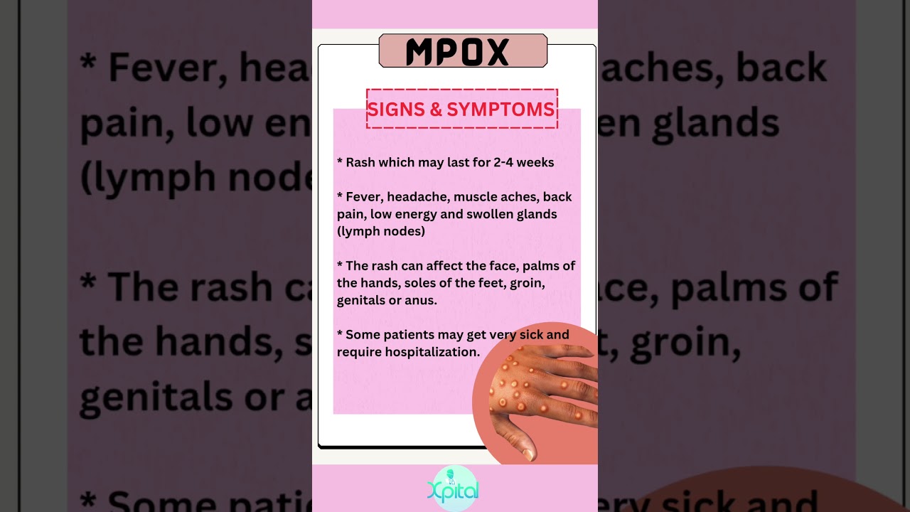 Mpox (monkeyрох) is a viral infection which can spread between people, mainly through close contact.