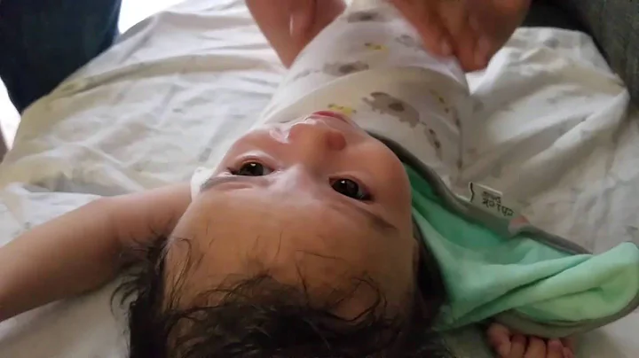 How to apply or insert Nose Stent For Baby after C...