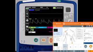 REALITi 360 1.4 12 Lead ECGs