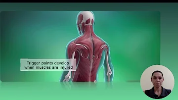 Como se formam os nódulos de tensão?