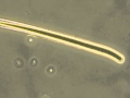 Algae microscopic exam Oscillatoria, Pediastrum, Anacystis, Euglena. 400x Phase Contrast