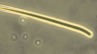 Algae microscopic exam Oscillatoria, Pediastrum, Anacystis, Euglena. 400x Phase Contrast