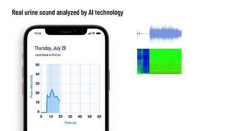 proudP: High Qmax Uroflow Curve