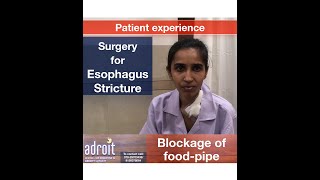 Surgery for esophagus stricture (Blockage of food pipe): Patient experience