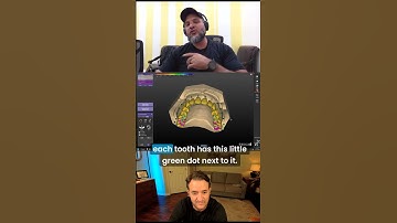 10 Minute Immediate Denture in exocad tips and tricks with Daniel Portal #shorts