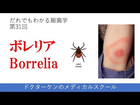 【だれでもわかる細菌学 第31回】ボレリアBorrelia (ライム病）