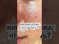 ЖИРНАЯ кожа! ЧТО ДЕЛАТЬ? #проблемнаякожа #жирнаякожа #аюна #кожа #уход #уходзажирнойкожей