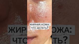 ЖИРНАЯ кожа! ЧТО ДЕЛАТЬ? #проблемнаякожа #жирнаякожа #аюна #кожа #уход #уходзажирнойкожей