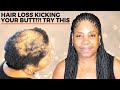 HOW TO BOX BRAID FOR BEGINNERS (ALOPECIA VERSION)