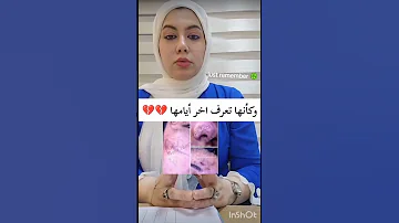 صورة ايد الدكتوره بان اكسبلور Explore قضية رأي عام لايك اشتراك بيبي سچينة ستوريات 