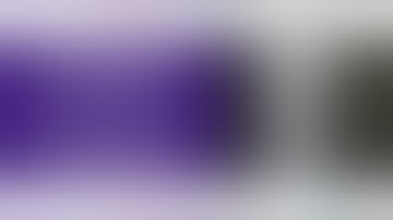 Principles of External Fixation