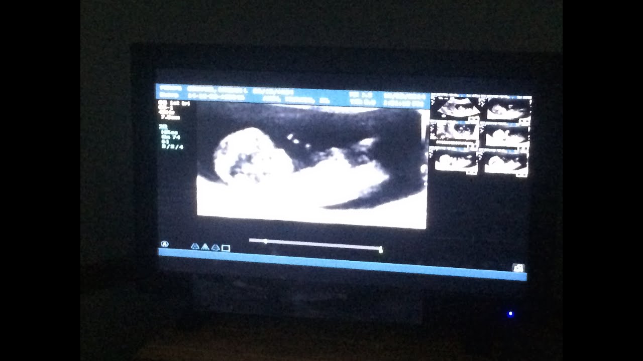 electronic pregnancy announcement