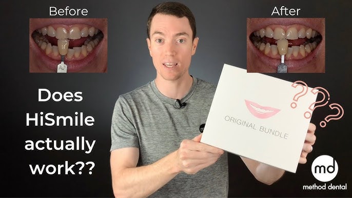 Hismile Review by a Real Dentist #shorts #patienteducation #teethwhitening  