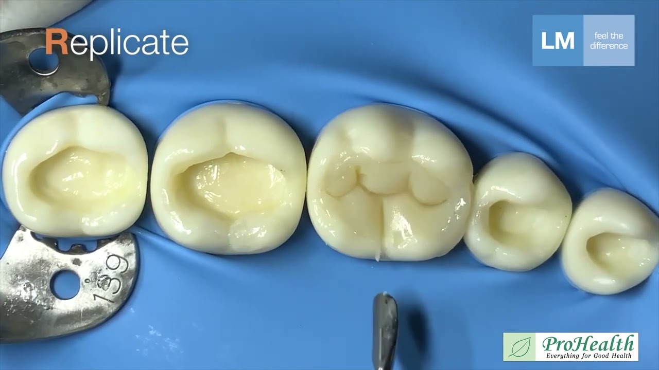 LM-Arte™ Replica Posterior - ProHealth