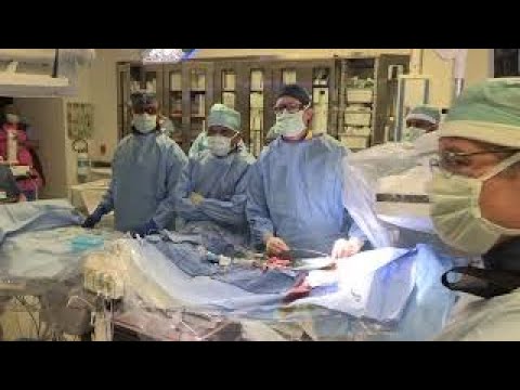 Step-by-Step Transcatheter Aortic Valve Replacement with a Self-Expanding Valve