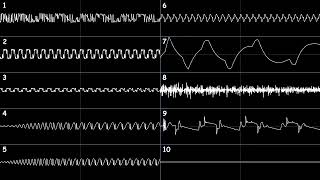 [YM2612 + 4×Generic PCM DAC, Furnace Tracker] Sonic the Hedgehog 2 - Mystic Cave Zone