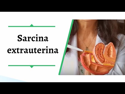 Video: Cum Se Confirmă Sarcina
