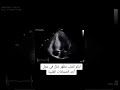 تصوير إيكو دوبلر بالأمواج فوق الصوتية للقلب يظهر خلل في عمل الصمام التاجي Dr Abdullah 