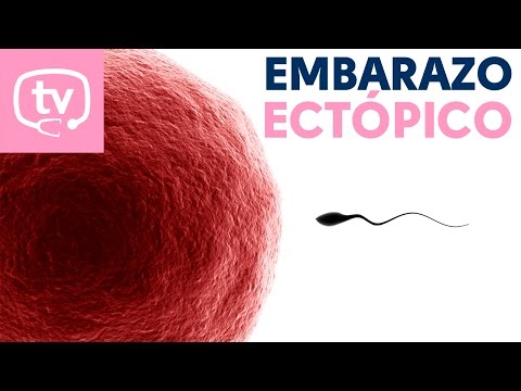 Vídeo: Què és un embaràs viable?