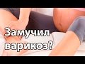 Варикоз и беременность. Профилактика варикоза. Упражнения | "До и После Родов"