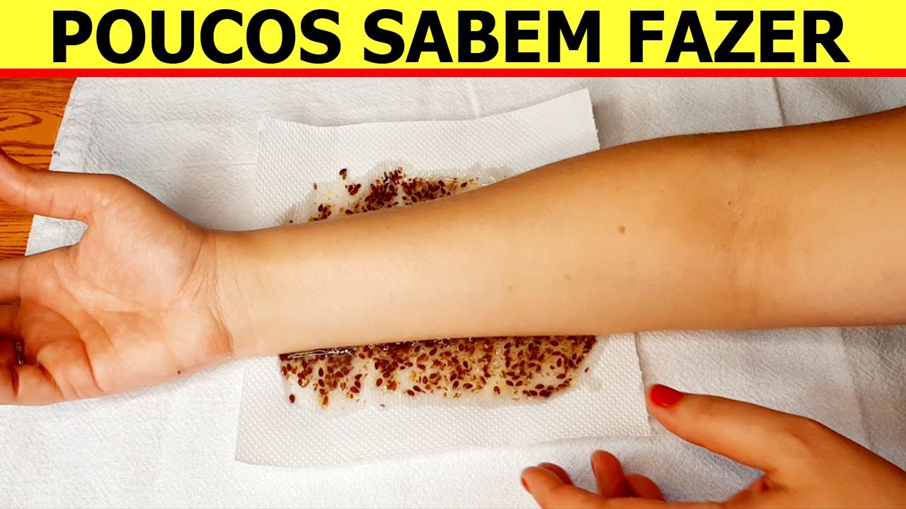 tratamento caseiro para tendinite no ombro tratamento caseiro para tendinite no ombro