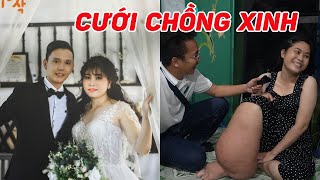 Thêm chuyện lạ ở Đồng Nai: Cô gái "chân voi" cưới chồng đẹp trai như diễn viên - ĐỘC LẠ BÌNH DƯƠNG