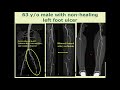 Noninvasive assessment of cli us cta mra  constantino pena md