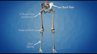 Low Back Pain Net Nugget — Sole Supports