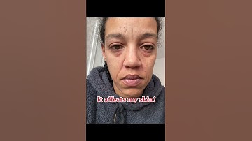 Loving with invisible illness #fibromyalgia #invisibleillness