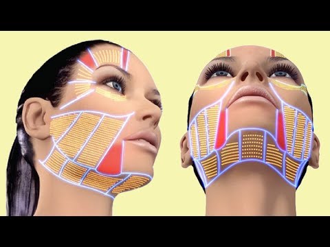 Лазерная Подтяжка Лица - Все Что О Ней Надо Знать