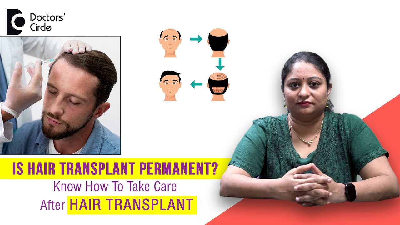 Is Hair Transplant permanent? Dos & Don'ts after Hair Transplant Dr