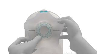 Sensura Mio Konkav 1-Teiliger Geschlossener Beutel - Anwendungsanleitung