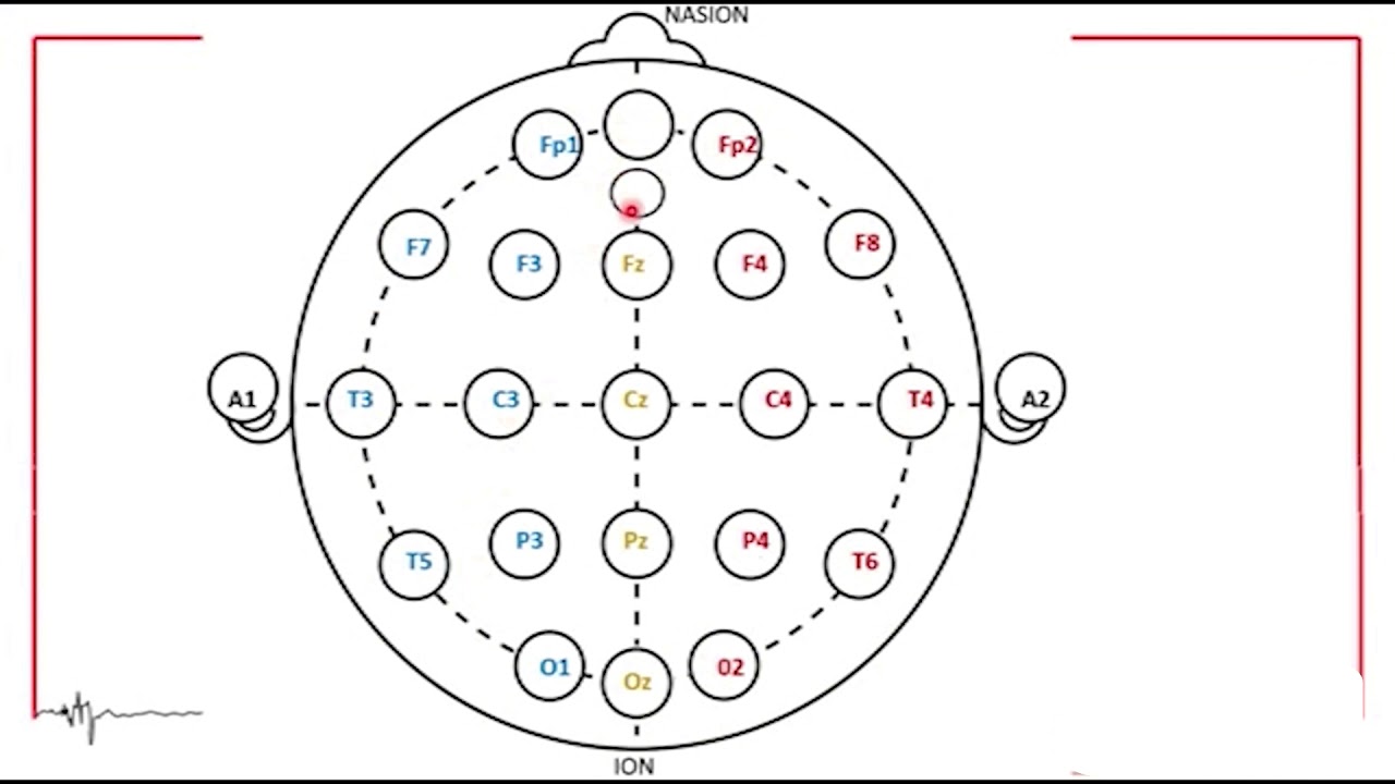 EEG Sistema 10 20 YouTube eeg-sistema-10-20-youtube