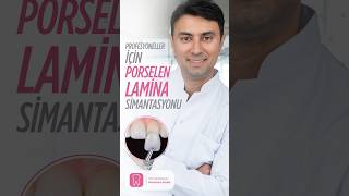 Profesyoneller İçin Porselen Lamina Simantasyonu