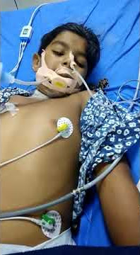 GBS disease of 12year children ( Guillain-Barré syndrome)