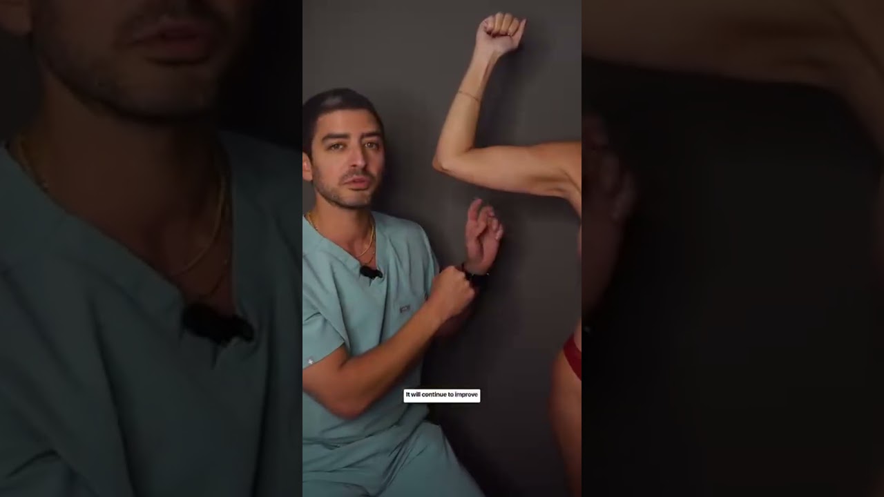 Many people think Renuvion skin tightening MUST pair with liposuction, but that’s not true! Here’s