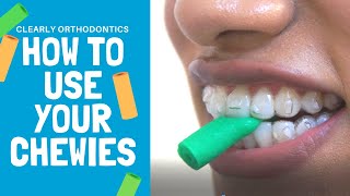 How to use Chewies / Invisalign Treatment