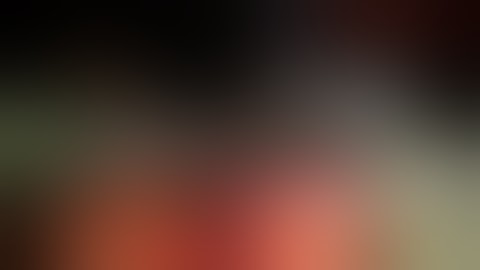 Robotic partial nephrectomy-Vloc renorrhaphy