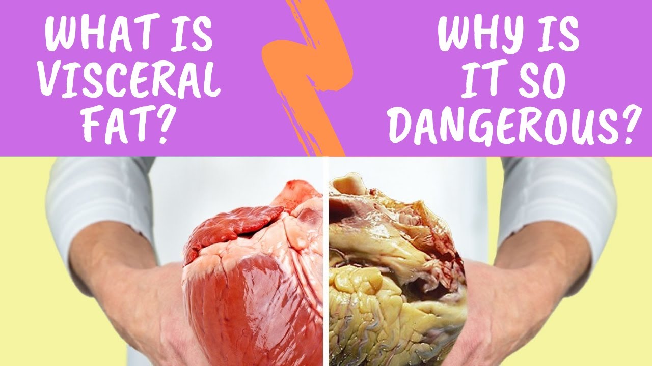 What Is Visceral Fat YouTube